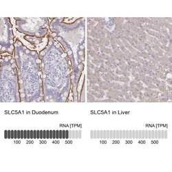 SGLT1/SLC5A1 Antibody, Novus Biologicals 25 &mu;L, Unlabeled:Antibodies,